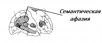 Схема мозга при семантической афазии
